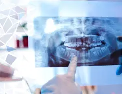 Ręka w rękawiczce wskazuje na zdjęcie rentgenowskie zęba (rtg zębów) pokazujące pełny zestaw zębów, z rozmytym tłem i geometrycznymi wzorami po lewej stronie obrazu.