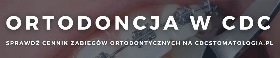 diastema - jak sobie z nią poradzić