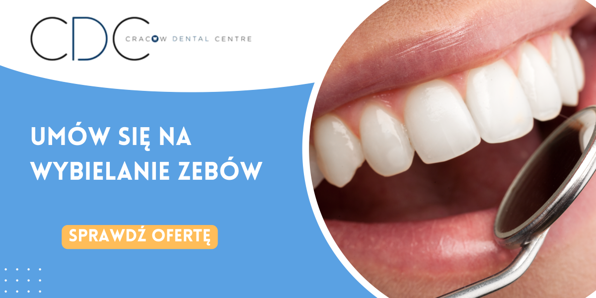 baner wybielanie zębów CDC Stomatologia