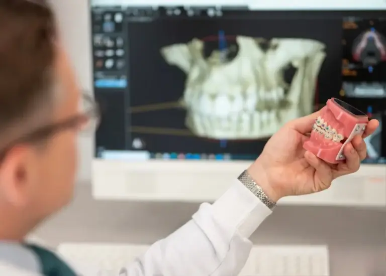 Dentysta trzyma model zęba z aparatem ortodontycznym, badając go, podczas gdy na ekranie komputera pojawia się zdjęcie rentgenowskie 3D - podkreślając zaawansowane techniki Ortodoncji stosowane w nowoczesnej opiece ortodontycznej.